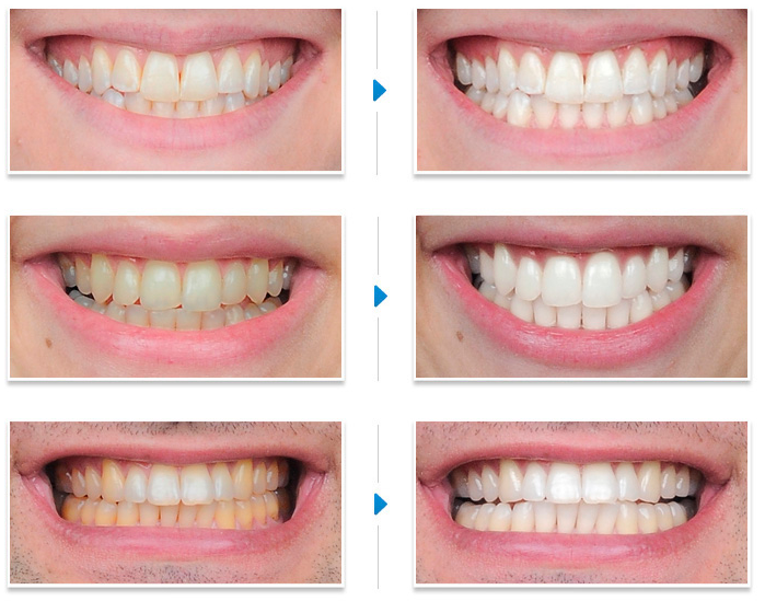 Smile Dental Clinic