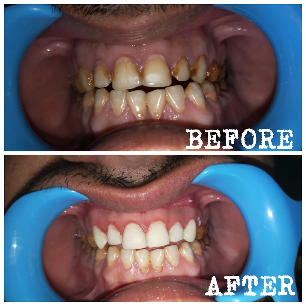 dental