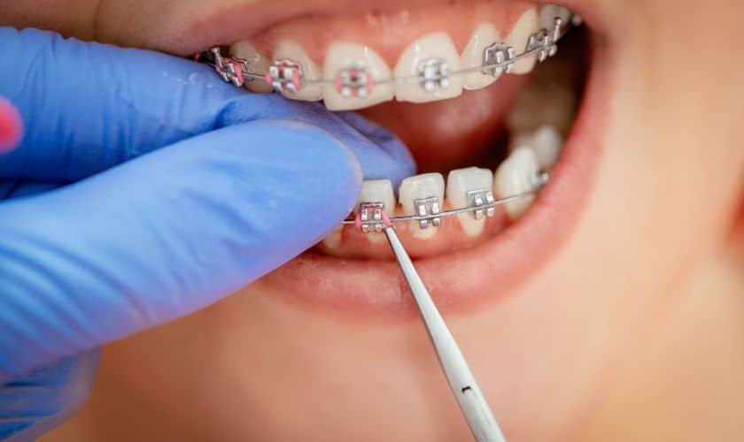 Orthodontics 