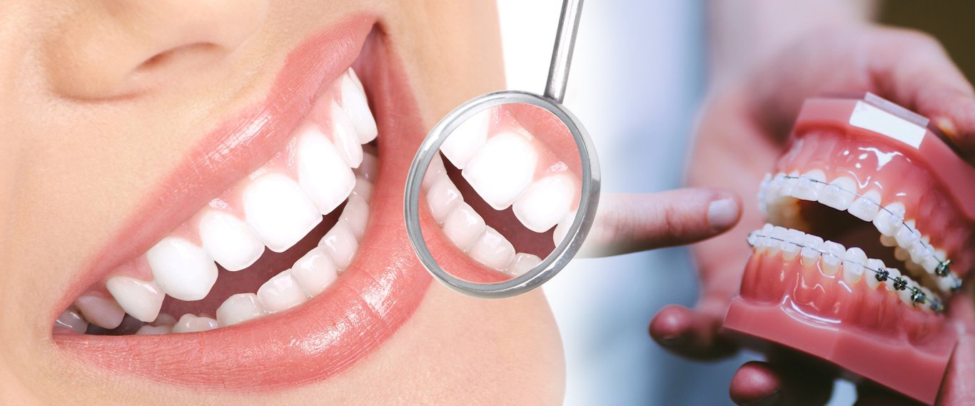 Transform Your Smile